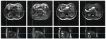 On the use of low-dimensional temporal subspace constraints to reduce reconstruction time and improve image quality of accelerated 4D-MRI